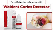 Easy Detection of Caries with Waldent Caries Detector