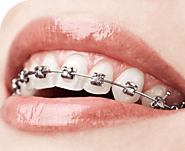 Lumina Dental| Dentist in Ultimo | Dental Practice Sydney
