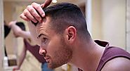 What To Do If Your Hair Transplant Treatment Failed – royal clinic
