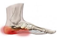 Preventative treatment and Rehabilitation for Plantar Fascia - Fitness Professional Online