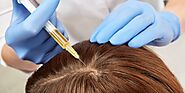 Best Hair Transplant in Ludhiana