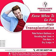 Hair Transplant in Ludhiana