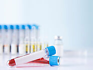 Blood Test Dubai | Blood Test/Lab Test at Home Services in Dubai