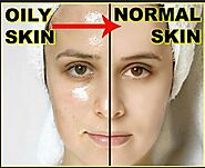 Why do I have Oily Skin? Hormones vs. Lifestyle – Timeless Skin Care Pakistan