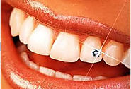 Dental Clinic in Sector 19 Noida –Tooth Jewelry