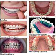 Orthodontic Treatment: Best Dentist in Noida