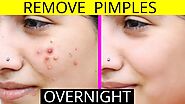The Best Way to Get Rid of a Pimple Overnight - Beauty For Pretty