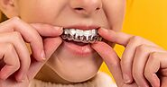 Which is better: braces or clear aligners? - Dr. Brock Rondeau & Associates