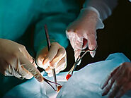 Phẫu thuật cắt bao quy đầu thẩm mỹ tại Thiện Hòa