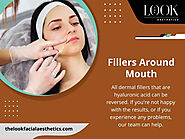 Fillers Around Mouth