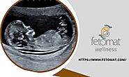 How Does First Trimester Screening Work?