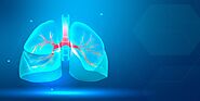 Why go for Lung Cancer Screening?