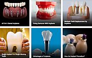 Get the Best Treatment for Oral Health Issues at Smilessence