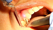 How The Laser Dentistry Has Been Incorporated To Treat Dental Issues?