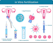 Common Reasons behind the Failure of IVF Cycles