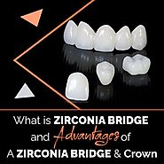 What Is Zirconia Bridge And Advantages Of A Zirconia Bridge & Crown