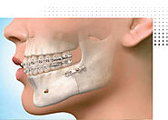 Orthodontics Treatment In Shivaji Nagar Pune