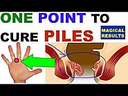 Sujok Therapy For Piles||Acupressure Points For Piles||Sujok Seed Therapy For Piles