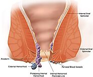 7 Most Effective Acupressure Points for Piles & Hemorrhoids - Acupressure Points Guide