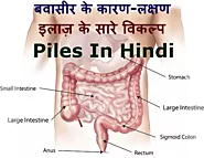 piles in hindi- बवासीर के कारण,लक्षण व् इलाज़ के सारे विकल्प