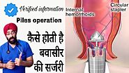 Piles Surgery | बवासीर की सर्जरी | Hemorrhoids Operation |Dr.Education