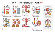 IVF Treatment in Turkey Istanbul | Best IVF Treatment Center