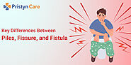 Key Differences Between Piles, Anal Fissures, and Anal Fistulas