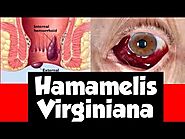 Hamamelis Virginiana | Hamamelis homeopathic medicine | Hemorrhoids | Haemorrhage | Varicose Vein