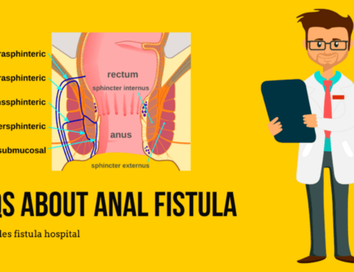 Shah Piles Fistula Hospital A Listly List