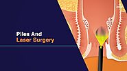 Piles And Laser Surgery | Piles Symptoms and Types | Piles Laser Treatment in Hyderabad