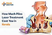 Piles Laser Treatment Cost in Kerala - Operation Cost | Piles Doctor