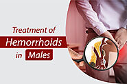 Treatment of Hemorrhoids in Males | Symptoms of Hemorrhoid in Male