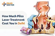 Piles Laser Treatment Cost in Delhi - Operation Cost | Piles Doctor