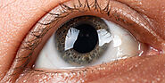 Cornea Surgery in Mumbai | Eye Specialist- Doctor Eye Institute