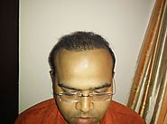 Dr. Dutt Hair Transplant Clinic, Noida, Hair Specialist