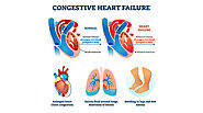 Congestive Cardiac Failure, Causes, Symptoms and Treatment | Dr. Raghu