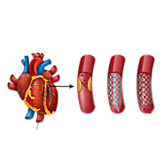 Best Heart Specialist and Cardiologist In Secunderabad | Dr C Raghu