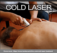 Top Cold Laser Treatment Services in South San Francisco