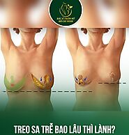 Treo Sa Trễ Bao Lâu Thì Lành? Bí Quyết Để Nhanh Hồi Phục