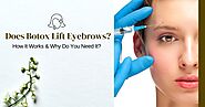 Does Botox Lift Eyebrows? How It Works & Why Do You Need It?