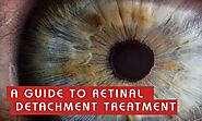 A Guide to Retinal Detachment Treatment