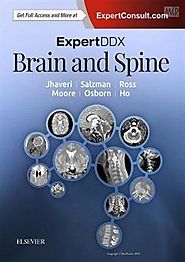 ExpertDDx: Brain and Spine 2nd Edition , Jhaveri and By author Ho and By author Moore, 9780323443081