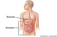 Gas and Bloating: Care Instructions