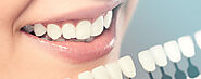 Cosmetic Dentistry Treatments | Teeth Whitening in Coimbatore