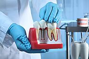What Is An Element About All On 4 Dental Implants