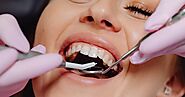 How to Choose the Best Dentist Guidance?
