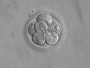 Embryo transfer - Wikipedia, the free encyclopedia