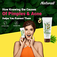 How Knowing the Causes of Pimples & Acne Helps You Prevent Them – Naturali