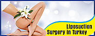 Liposuction surgery – benefits, treatment options, procedure costs and top medical centers