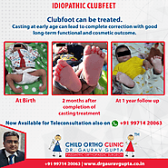 Best Pediatric Orthopedic Doctor in Delhi